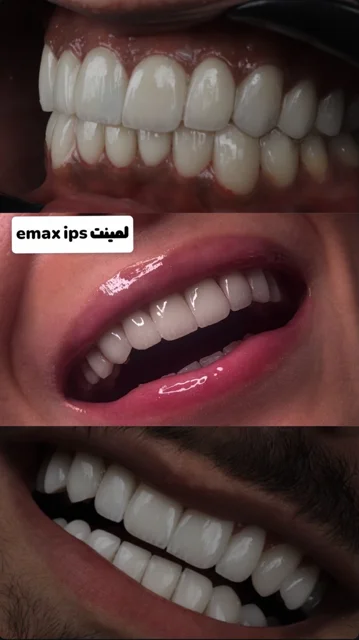 لمینیت