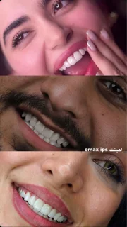 لمینیت