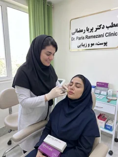 فیلر لب